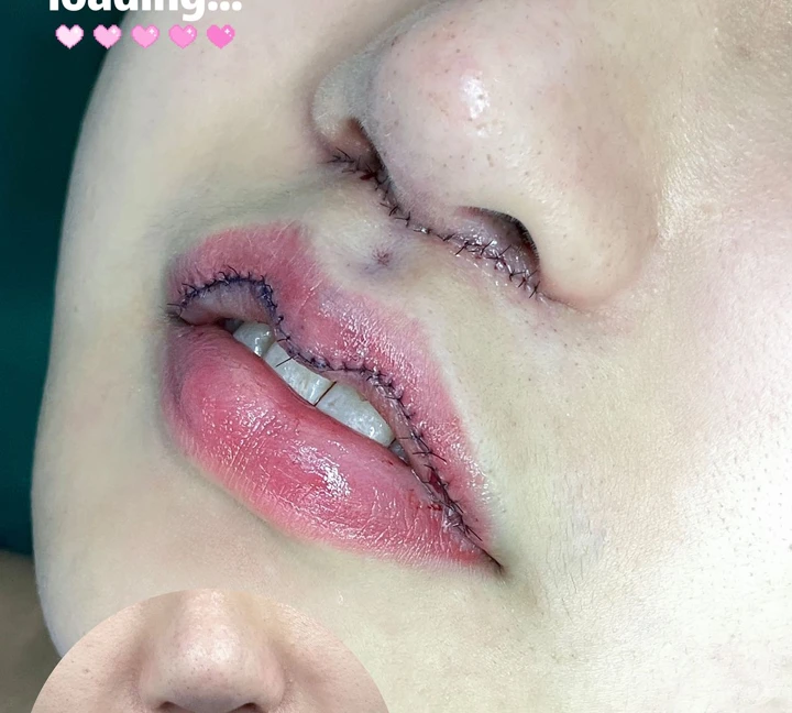سجل الشفاه والنثرة مباشرة 01