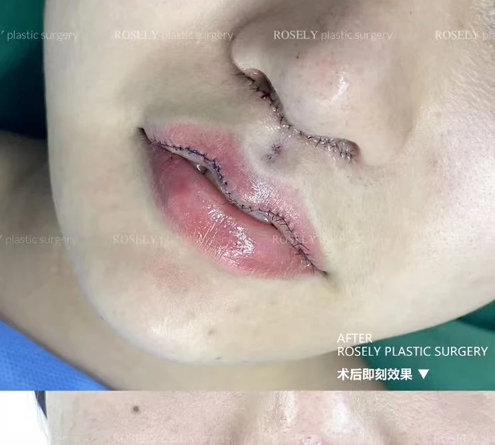 سجل الشفاه والنثرة مباشرة 02