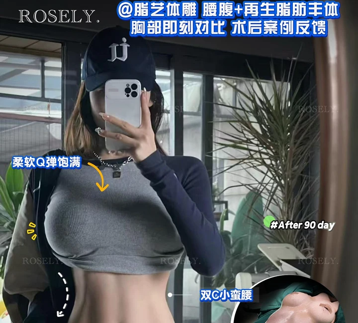 Waist contouring & breast fat procedures